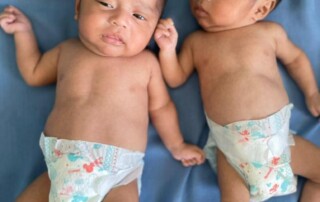 chubby twins after nutritional intervention